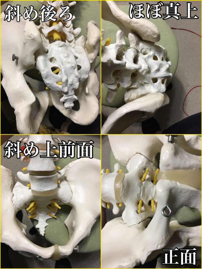 骨盤を自分で矯正する方法