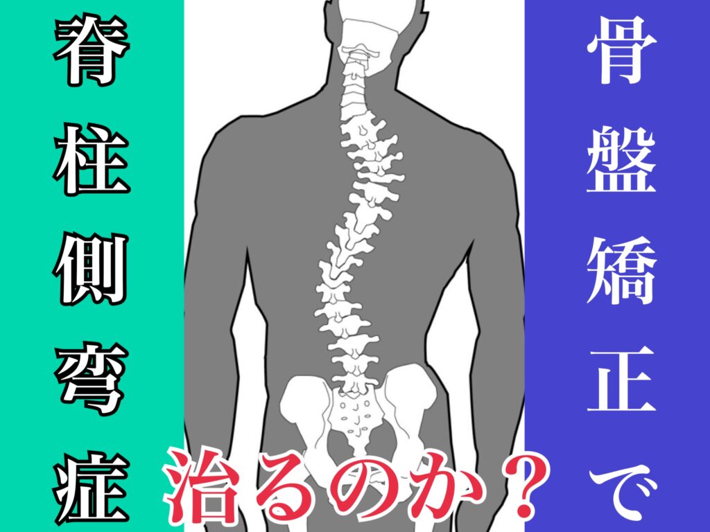 骨盤矯正で脊柱側弯症は治るのか？